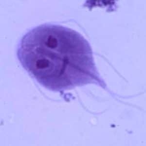 la Giardia
